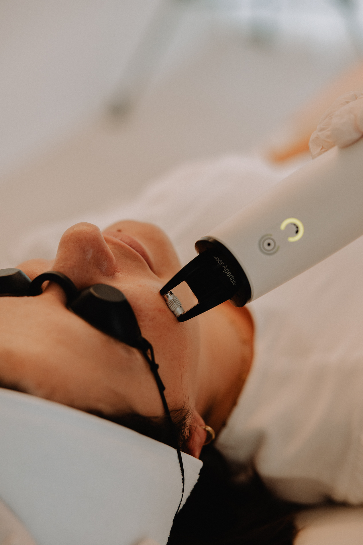 Fractionele laserbehandeling