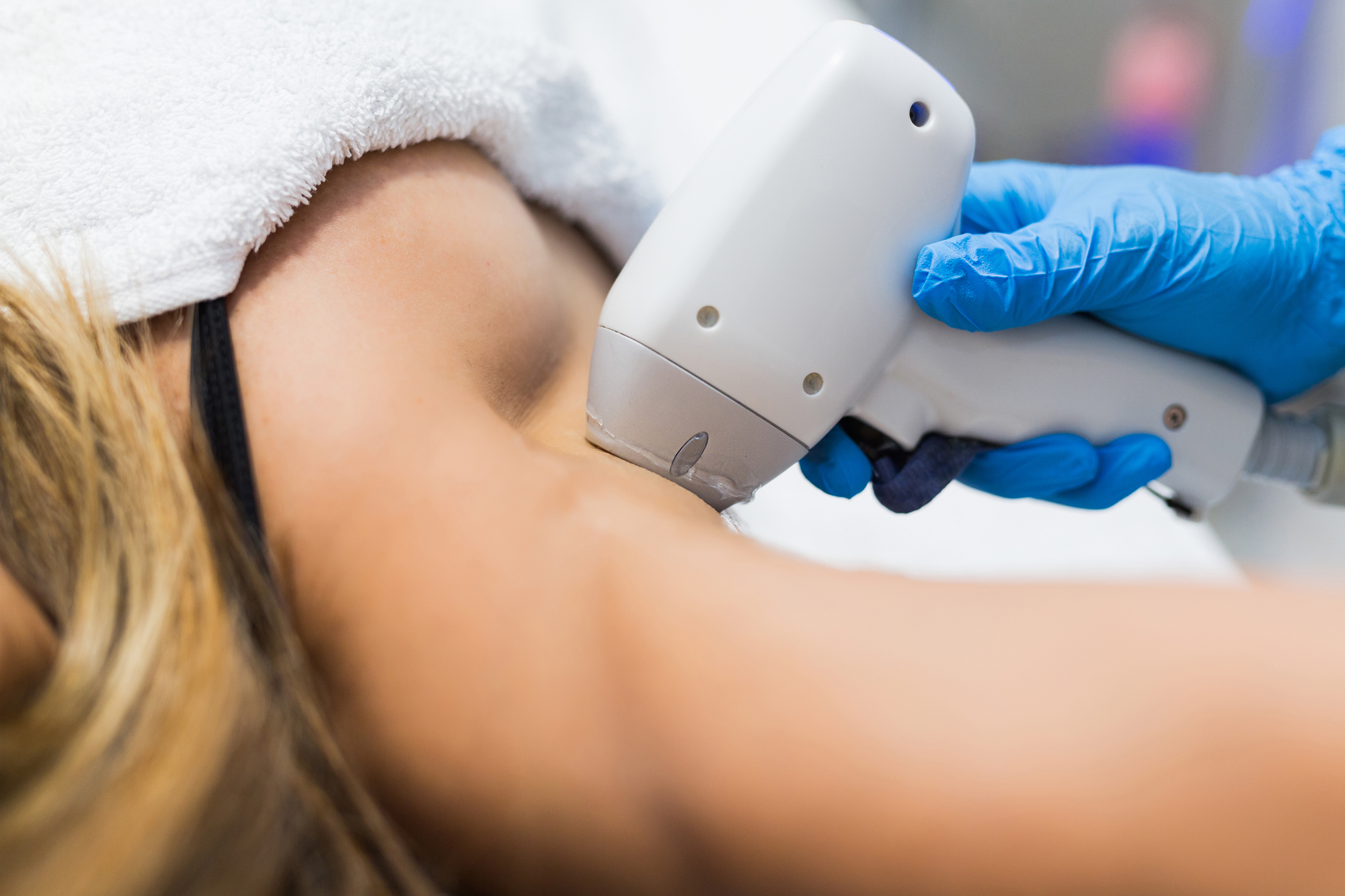 What are the benefits of a Candela GentleMax Pro Plus laser treatment?