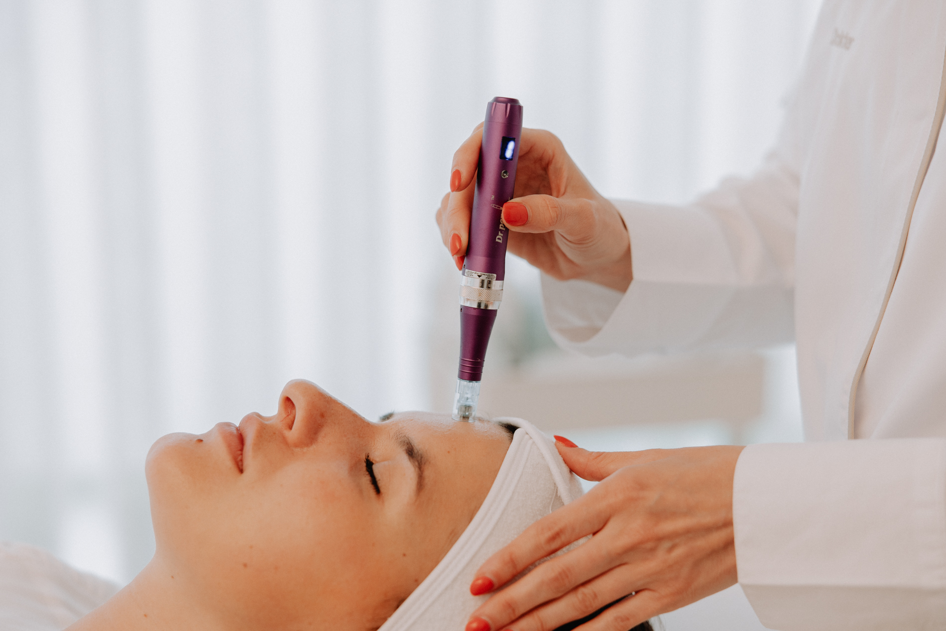 Platelet Rich Plasma of PRP gezicht